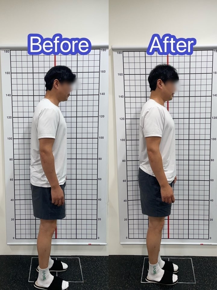 [고양/교정] 베OO바디