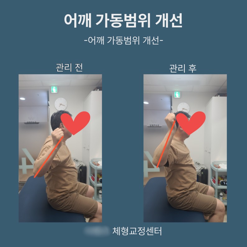 [N클립/부산/교정] 더OO 체형교정센터