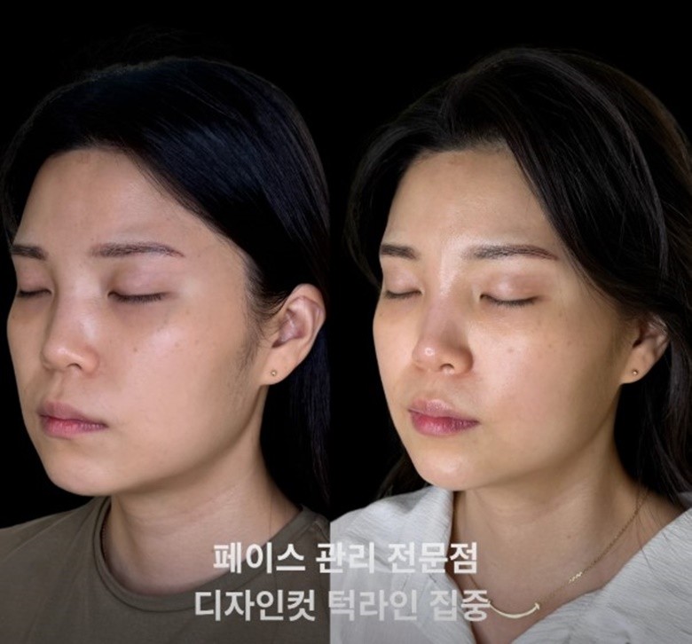 [N클립/서초/뷰티] 로OOO떼 서초 잠OO점