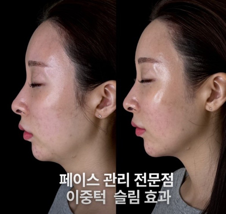[서초/뷰티] 로OOO떼 서초 잠OO점
