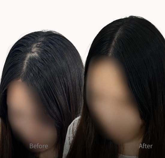 [부산/뷰티] 헤O민 부산서면점